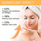The Ordinary Glycolic Acid 7% Full Body, Removes Dead Skin Cells, Brightens & Smoothens